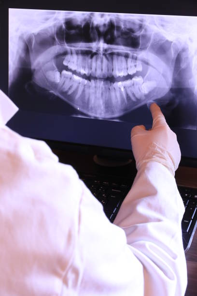 Best Emergency Broken Tooth Repair in Cape May Court House, NJ