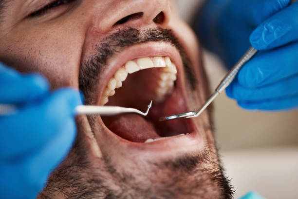 Best Emergency Treatment for Toothache in Cape May Court House, NJ