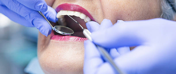 Best Emergency Treatment for Toothache in Cape May Court House, NJ